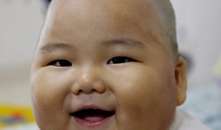 Bebé chinês tem 20 quilos com apenas dez meses de idade 1
